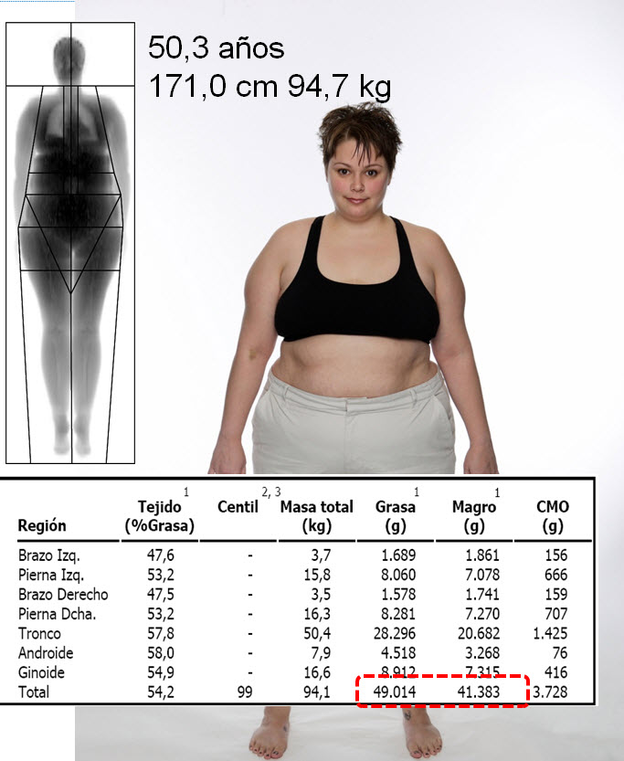 Tabla y foto masa corporal, grasa. El maldito peso. Centro Pronaf